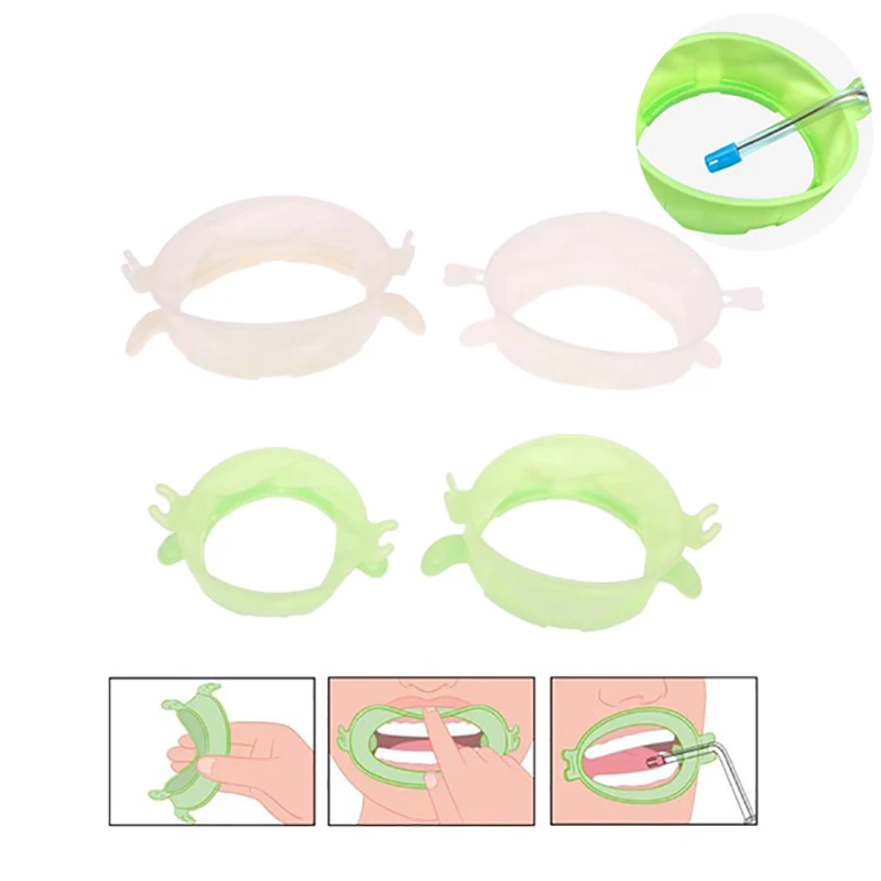 Retractor de labio Dental S/M/ - Teeth Whitening Zoom reseña y precio
