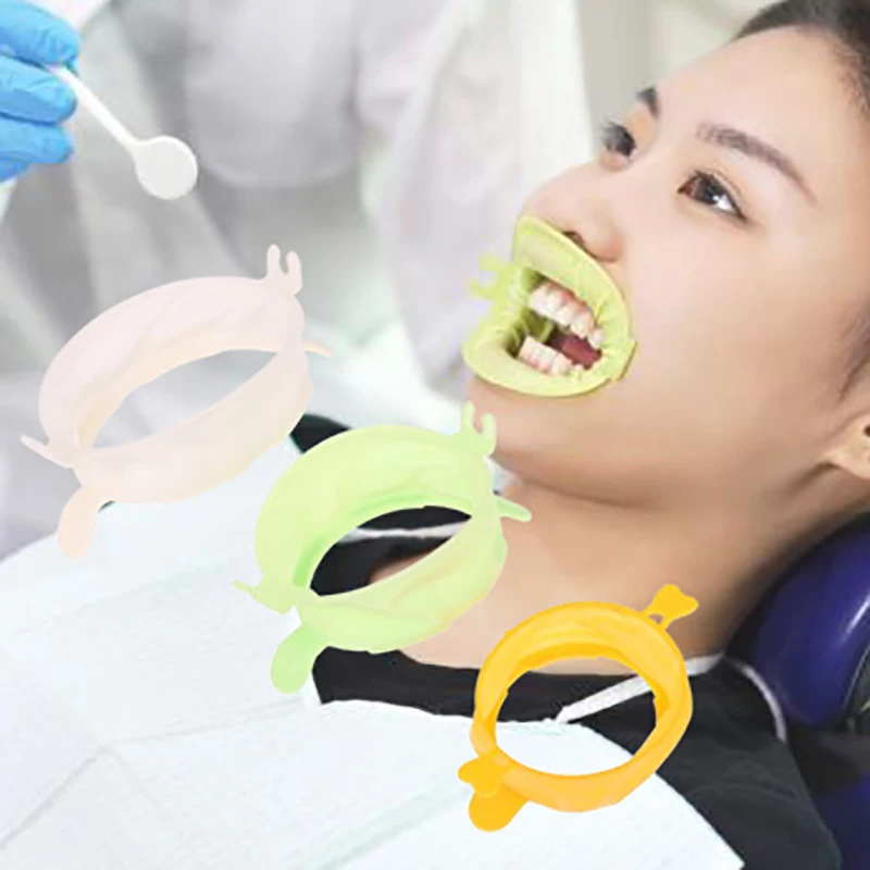 Retractor de labio Dental S/M/ - Teeth Whitening Zoom reseña y precio