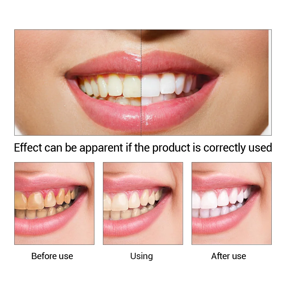 FTEENPLY-esencia para blanquea - Teeth Whitening Flash reseña y precio